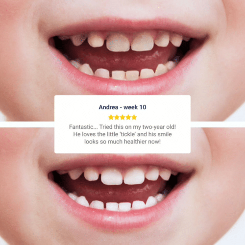 Wellawhite Electric Toothbrush (Official Retailer) [year]