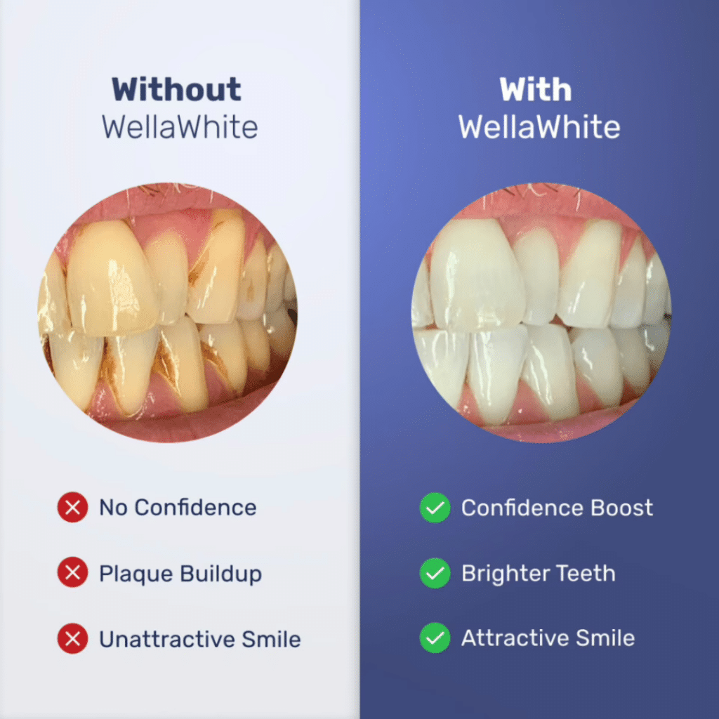 Wellawhite Electric Toothbrush (Official Retailer) [year]
