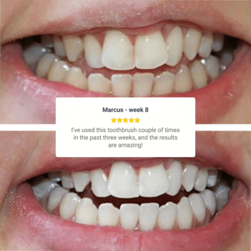 Wellawhite Electric Toothbrush (Official Retailer) [year]