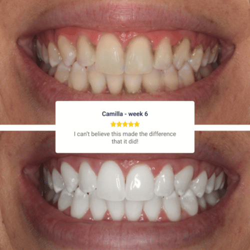 Wellawhite Electric Toothbrush (Official Retailer) [year]